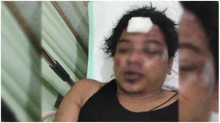 PELAKU BEGAL - SA (33) warga Kecamatan Maron, Kabupaten Probolinggo,babak belur dihajar korbannya lalu diamankan pihak kepolisian setelah membegal di Desa Temenggungan, Kecamatan Krejengan, Jum'at (31/10/2025). Pelaku lain berhasil melarikan diri.