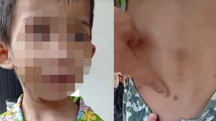 BOCAH DIANIAYA IBU TIRI: Tangkapan layar penampakan bocah di Bogor yang dianiaya ibu tiri. Sebelum tewas, sang bocah terlihat memiliki luka di sekujur tubuh.