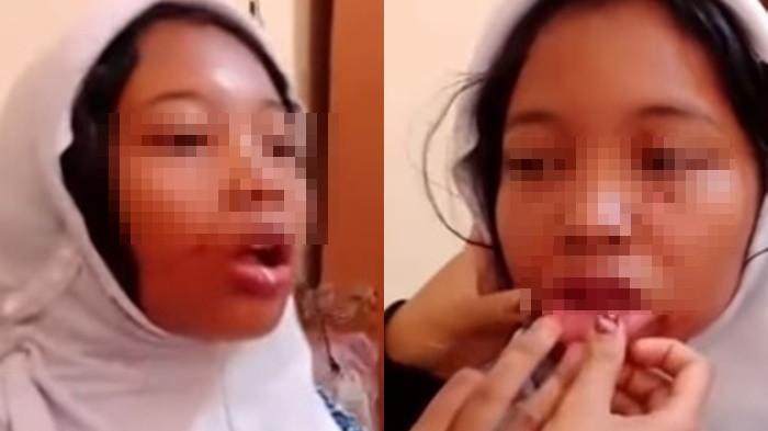 Kondisi Siswi SMPN 31 Palembang Dikeroyok Teman Satu Sekolah