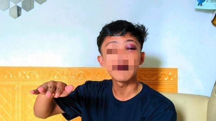 Abdul Aziz Dianiaya Polisi, Mata Bengkak Dipukul Pakai Senjata, Diberi Uang Tutup Mulut Rp50 Ribu