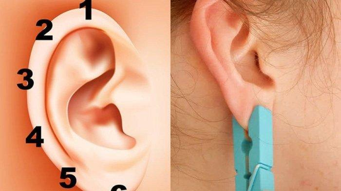 Terdengar Aneh, Ternyata Menjepit Telinga dengan Penjepit Jemuran Punya Manfaat Baik buat Tubuh