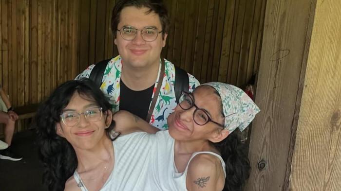 Kisah pernikahan wanita kembar siam Amerika Serikat