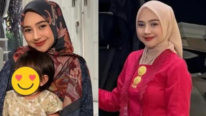 Penampilannya Bikin Pangling, Ria Ricis Ungkap Biaya Operasi Hidung ...