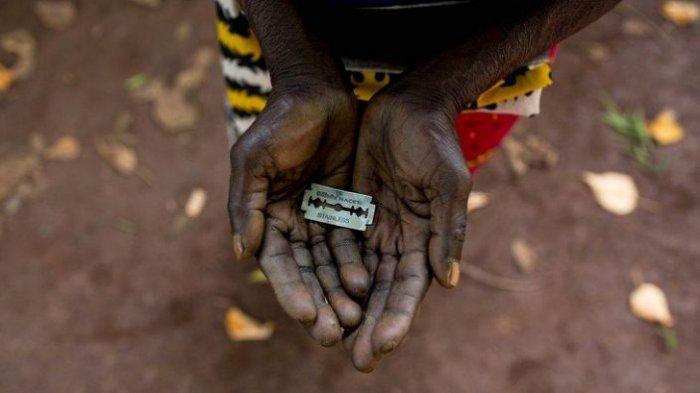 Sembilan Dari 10 Wanita Sudan Dikhitan