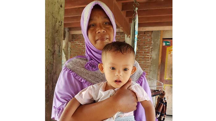 Bocah Bocor Jantung Asal Pidie Butuh Perhatian, Ini yang Diharapkan