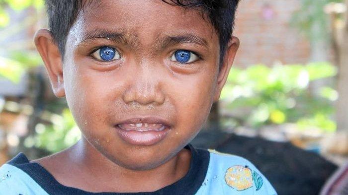 Bocah Asli Indonesia Ini Viral, Fardan Punya Mata Biru Bak Bule Eropa, Orangtua Ungkap Rahasia Ini