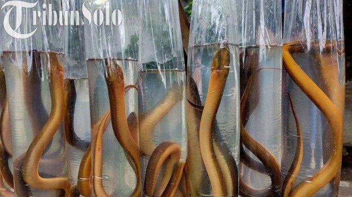 Belut 30 Cm Ditemukan Berenang di Perut Pria 33 Tahun, Ketahuan Saat Datangi UGD Karena Sakit Perut