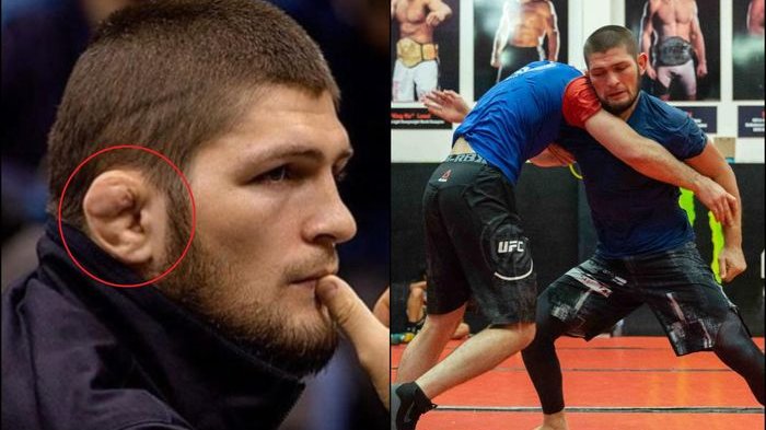 Telinga Kanan Khabib Nurmagomedov Terkena Penyakit Cauliflower: Ini Penyebab Hingga Pencegahannya