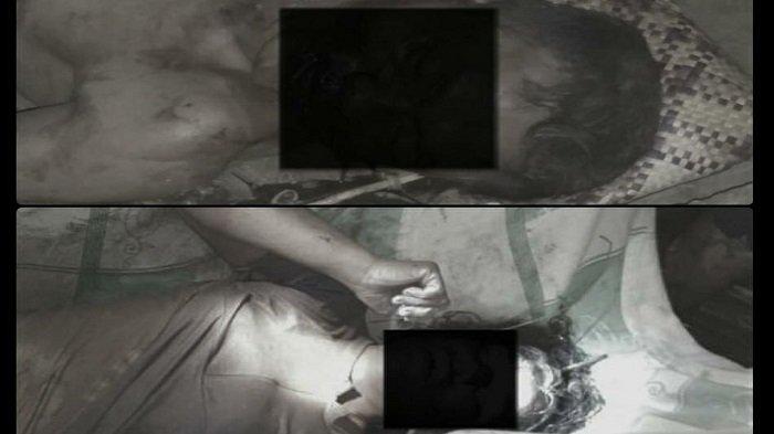 Sepasang Suami Istri Diduga Bunuh Diri dengan Meminum Racun Rumput, Mulut Keduanya Mengeluarkan Buih