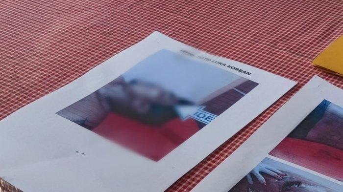 Gegara Geber-geber Motor, Pria Ini Tewas Dibacok Gerombolan Pemuda yang Terganggu Suara Bising