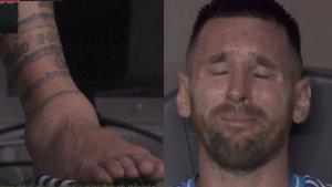 Ankle-kaki-kanan-Lionel-Messi-yang-bengkak-saat-laga-final-Copa-America-2024.jpg