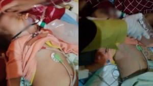 Balita-1-tahun-8-bulan-di-Seluma-yang-keluar-cacing.jpg