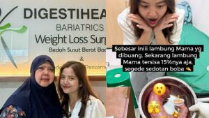 OPERASI-POTONG-LAMBUNG-IBU-TASYA-KAMILA.jpg
