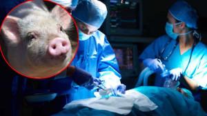 Pria-71-Tahun-di-China-Bertahan-Hidup-171-Hari-Usai-Jalani-Transplantasi-Hati-Babi.jpg