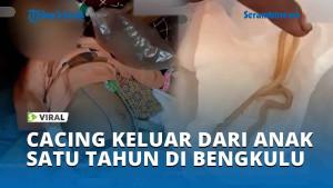 Viral-Terjadi-Lagi-Cacing-Keluar-dari-Anak-Satu-Tahun-di-Bengkulu.jpg