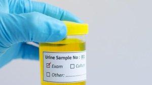 ilustrasi-urine-kuning.jpg