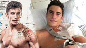marc-marquez-sudah-jalani-latihan-pertama-pasca-operasi-punggung.jpg