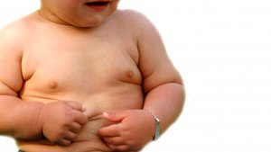 obesitas-anak_20180508_123021.jpg