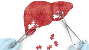 prodia_promo-prohealthy-liver-2021.jpg