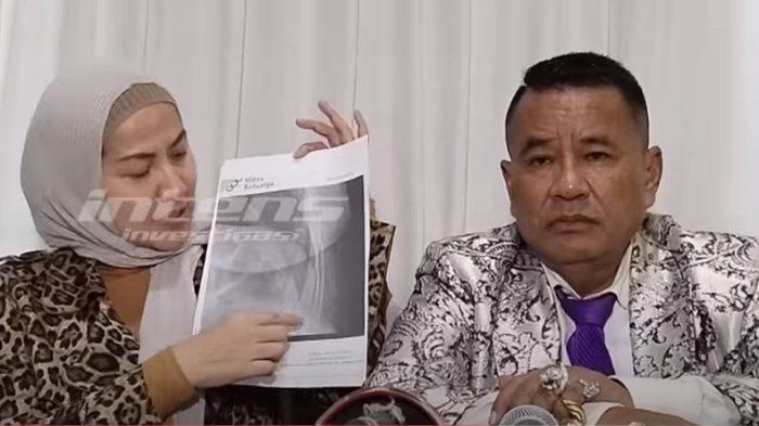 Venna-Melinda-tunjukkan-bukti-tulang-rusuknya-retak-karena-KDRT.jpg