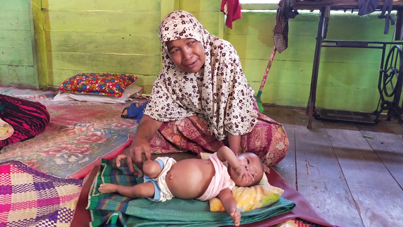 Seorang Bayi di Aceh Timur Kelainan Jantung, Orangtua Terkendala Biaya ke RSUZA Hingga Butuh Bantuan