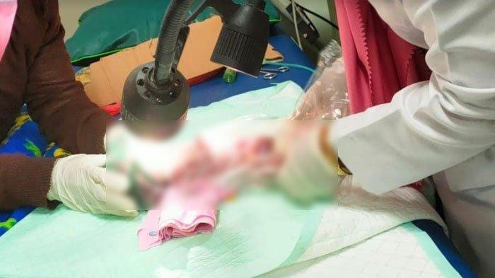 Bayi Dibuang Hidup-hidup di Tempat Sampah, Polisi Tangkap Ibu Bayi yang Masih di Bawah Umur
