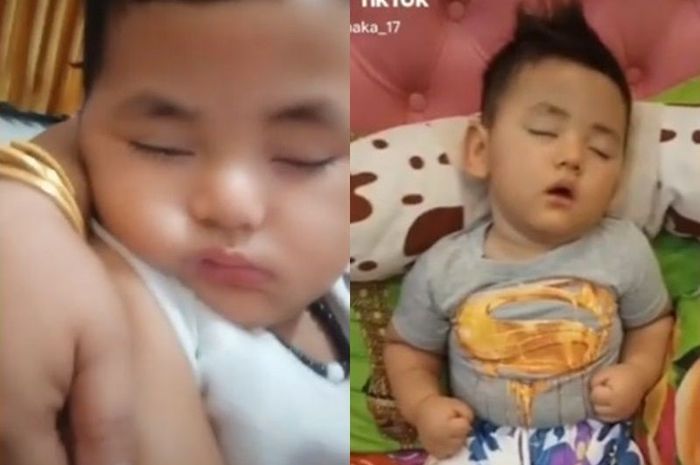Bayi 18 Bulan Sempat Dirukyah karena Tertidur Selama Setahun, Ternyata Ini Penyakit yang Dideritanya