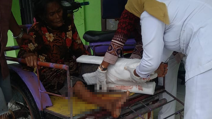 Pengendara Vixion Tabrak Wanita Pendayung Sepeda di Pidie Jaya, Korban Patah Kaki dan Luka-luka