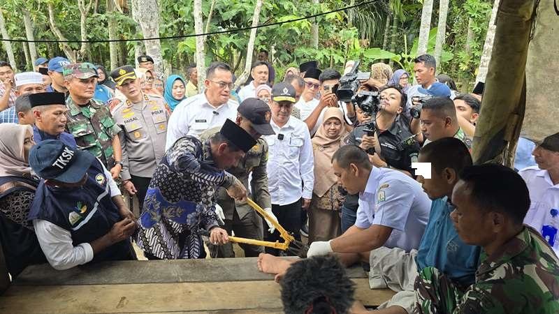 21.000 Warga Aceh Gangguan Jiwa, 114 di Antaranya Dipasung, Pj Gubernur Canang Aceh Eliminasi Pasung