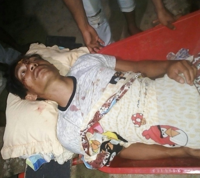 Konflik Buaya Versus Nelayan Pulau Banyak Barat Terus Terjadi, Ini Data Korbannya