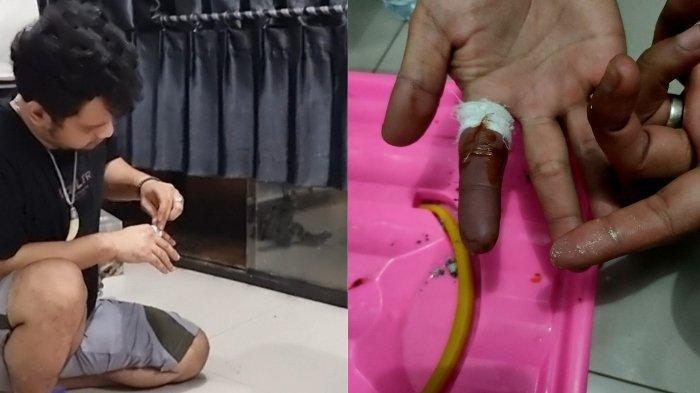 Panji Petualang Digigit Ular Berbisa hingga Tangan Menghitam dan Membengkak, Begini Kondisinya