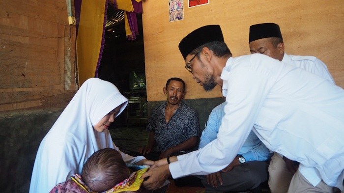 TA Khalid Fasilitasi Bayi Penderita Pembengkakan Kepala di Aceh Tamiang untuk Dirujuk ke RSUZA