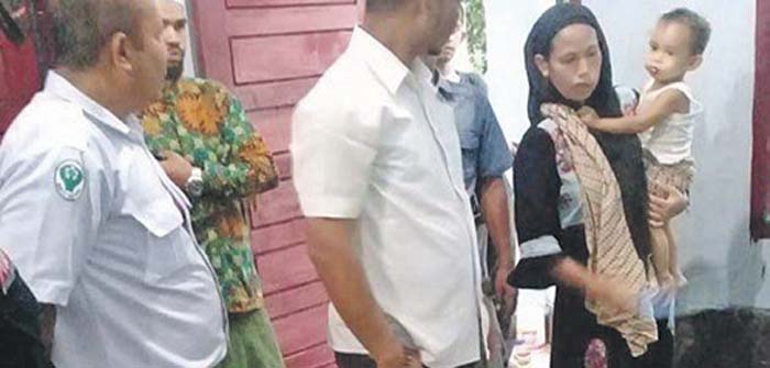 Derita Afika, Bocah Korban Kebakaran di Pijay Jalani 42 Kali Operasi Plastik Selama Lima Bulan