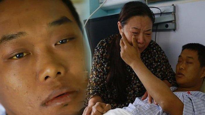 Pemuda Ini Derita 16 Penyakit Karena Kebiasaan Begadang dan Makan Mie Instan, Sang Ibu Menangis