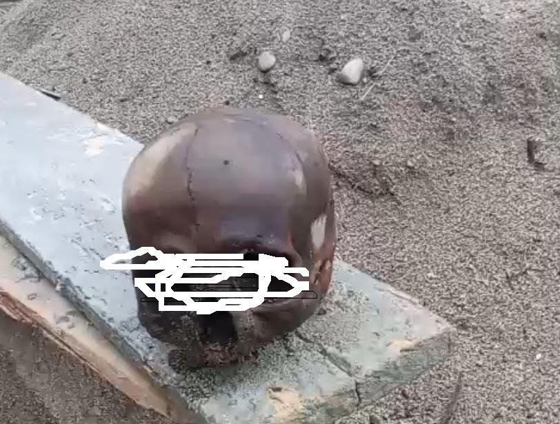 BREAKING NEWS - Geger Diduga Tengkorak Manusia Ditemukan di Material Pasir di Aceh Selatan