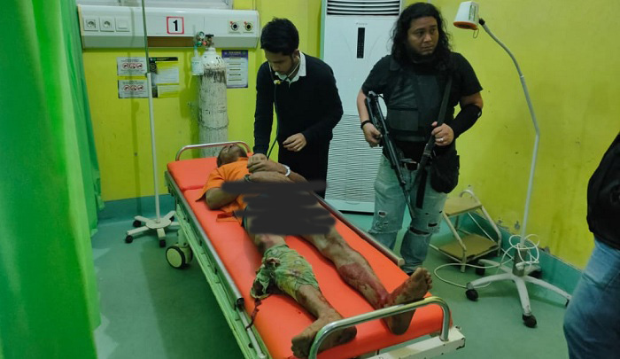 Coba Serang Petugas dengan Pisau, Betis Tersangka DPO Pembunuhan Keuchik Alue Kaol Didor