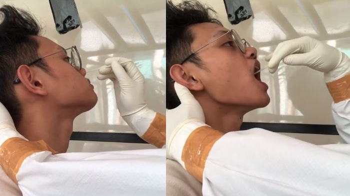 Viral, Pemuda Ini Abadikan Video Saat Jalani Swab Test Covid-19, Ini yang Ia Rasakan