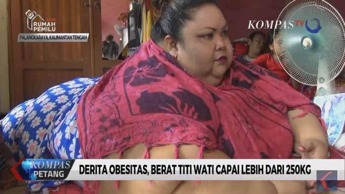 Belajar dari Kasus Obesitas Titi Wati, Gemar Ngemil Ternyata Lebih Bahaya daripada Makan Nasi