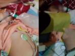 Ngeri! Cacing Gelang Keluar dari Mulut Hidung Bocah di Bengkulu, di Perut Ada Gumpalan Diduga Sarang