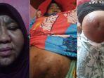 Janda-asal-Bireuen-Alami-Pembengkakan-Perut-di-Malaysia-Uang-Habis-untuk-Berobat-Kini-Terlantar.jpg