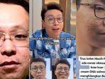 Richard-Lee-sebut-kontras-HP-yang-membuat-bopeng-di-wajahnya-terlihat-Tiktok.jpg