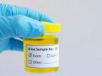 ilustrasi-urine-kuning.jpg