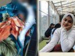 seorang-istri-di-cianjur-yang-jadi-korban-penyiraman-air-keras-oleh-suaminya-kini-meninggal-dunia.jpg