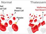 thalassemia_20151107_101426.jpg
