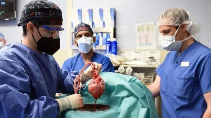 2 Bulan Setelah Dioperasi, Pasien Pertama Transplantasi Jantung Babi Meninggal Dunia