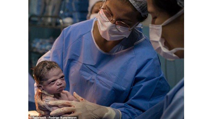 Seorang Bayi Tampak 'Marah' saat Dilahirkan, Dokter Coba Membuatnya Menangis, Perhatikan Ekspresinya