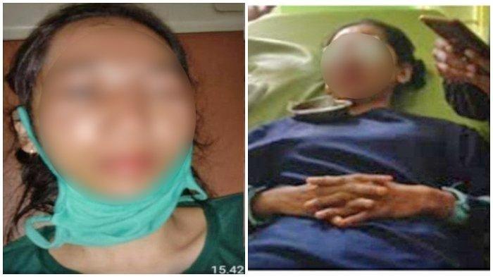 Cinta Bertepuk Sebelah Tangan, Pria Ini Nekat Siram Air Keras ke Wajah Wanita, Kini Terancam Buta