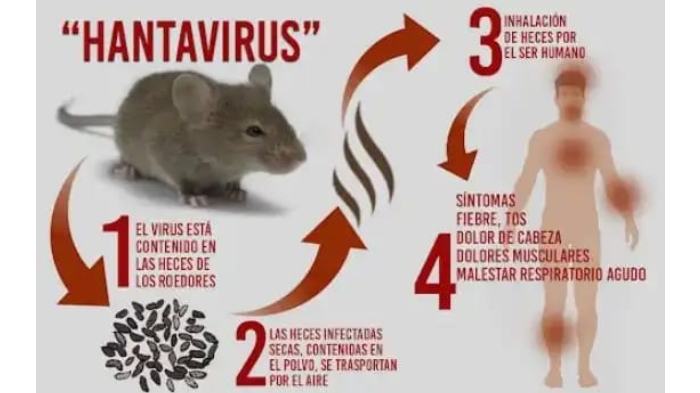 hantavirus-symptoms.jpg
