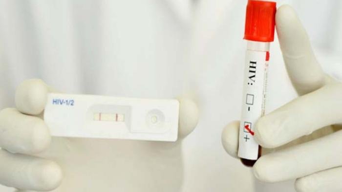 Bocah 9 Tahun di Surabaya Meninggal karena HIV yang Tertular dari sang Ibu