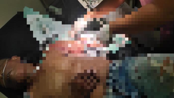 TEWAS Pasca Terlindas Truk Fuso, Widiani Tewas di TKP, Kecelakaan Ruas Jalan Singaraja - Seririt!